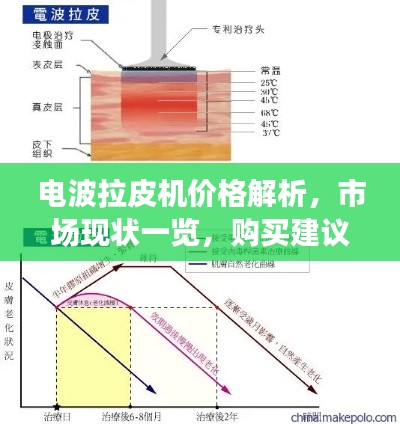 电波拉皮机价格解析,市场现状一览,购买建议助你明智选择
